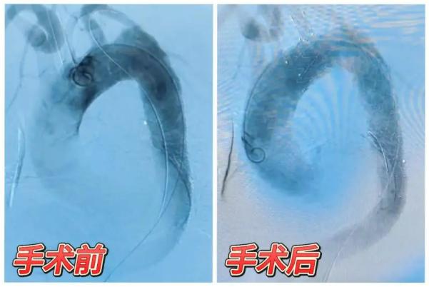 心胸外